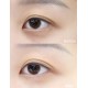DERMAFIX Eye Patch (PREORDER 7 - 14 DAYS)